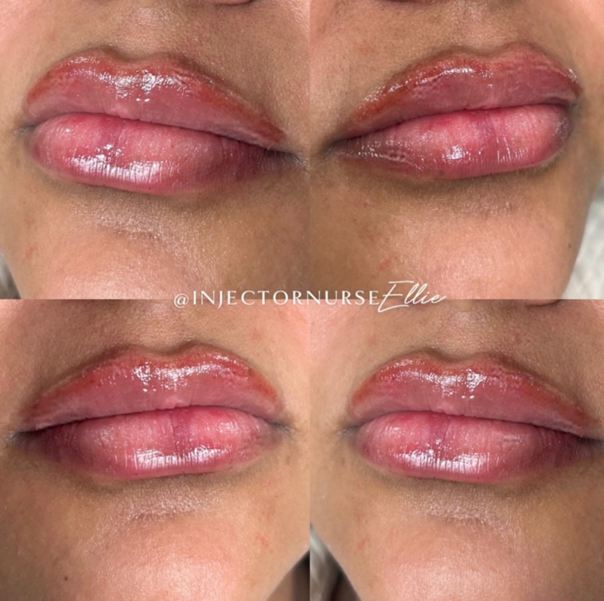 b12 injections san fernando valley Ellie Lambert NP – Master Aesthetic Injector in Woodland Hills A Self-Injectable Birth Control cat digestion support Quantity:10 Vials